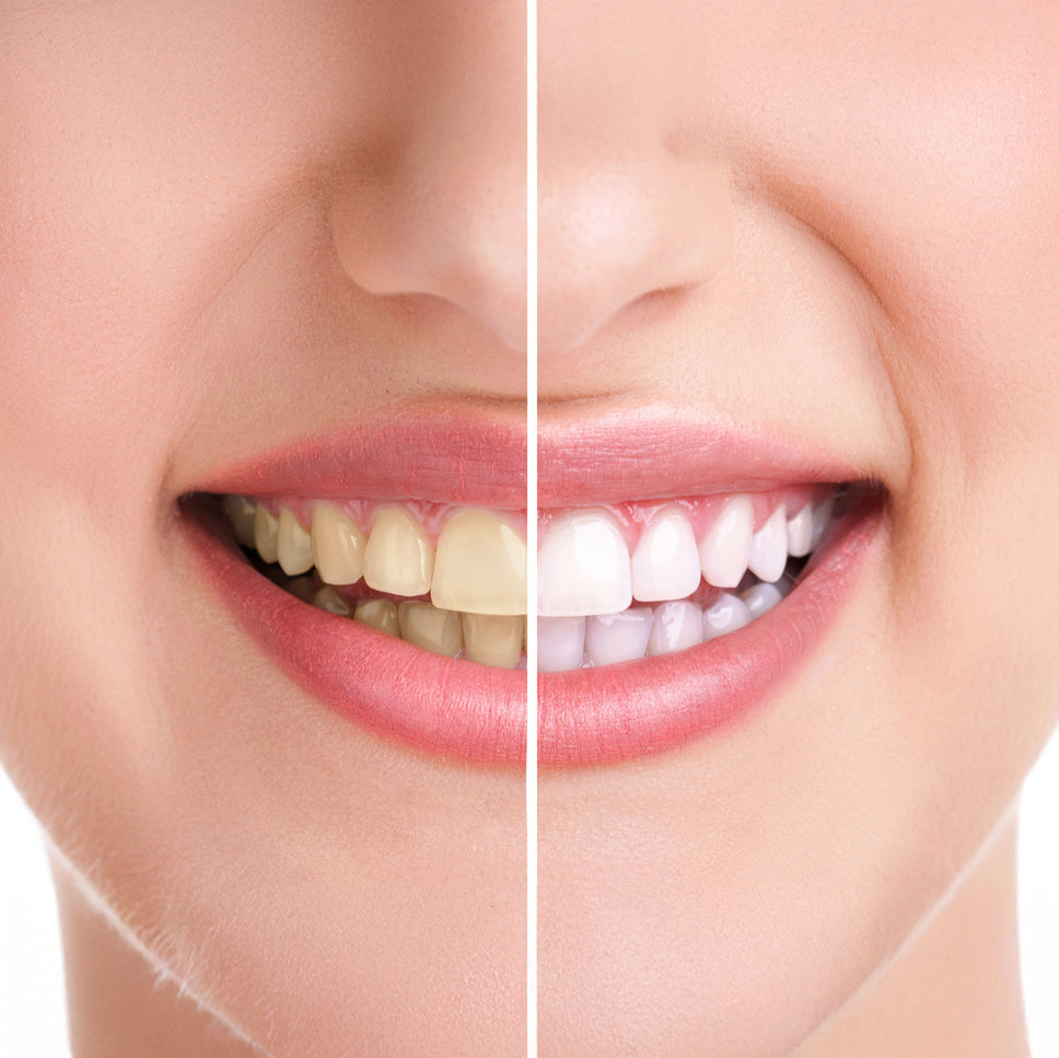 PAP korvasi peroksidin kotivalkaisuissa